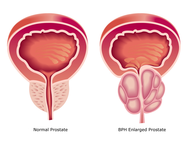 What is the normal size of the prostate?