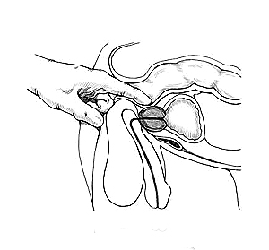 prostate self exam prostate self exam