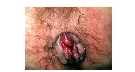 External Prostate Orgasm 14