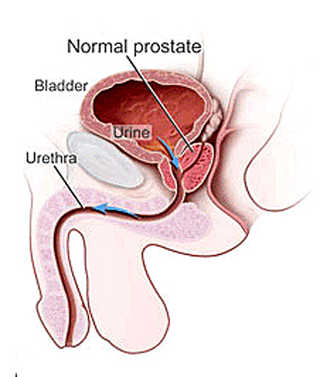 Normal healthy prostate