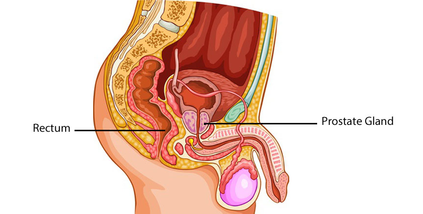 does colon cleansing work for the prostate gland?