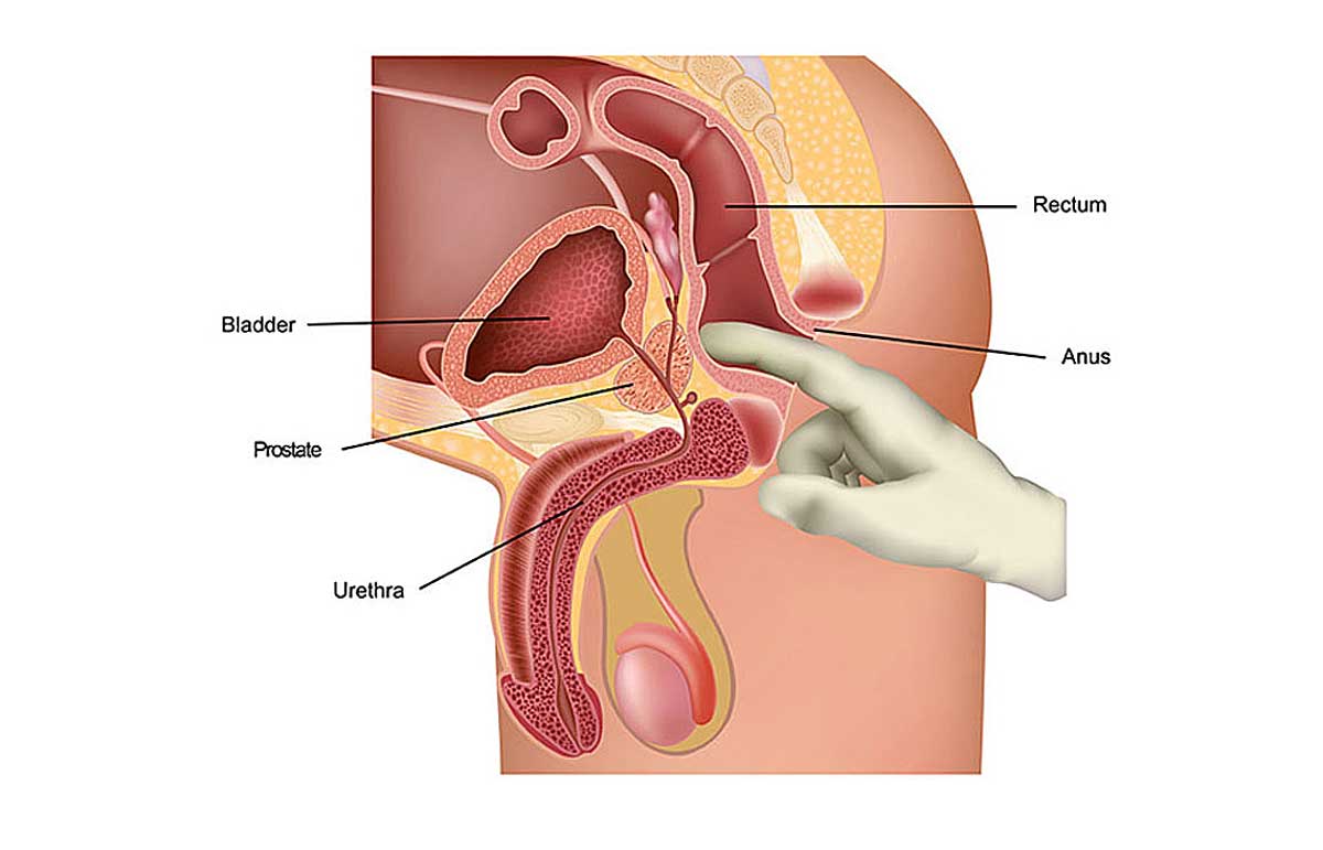 prostate massage technique
