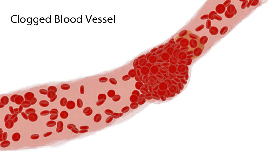 penis massage, clogged blood vessels, and weak erections