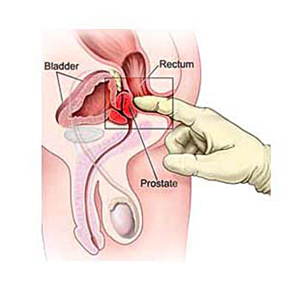 body work for prostate health #2