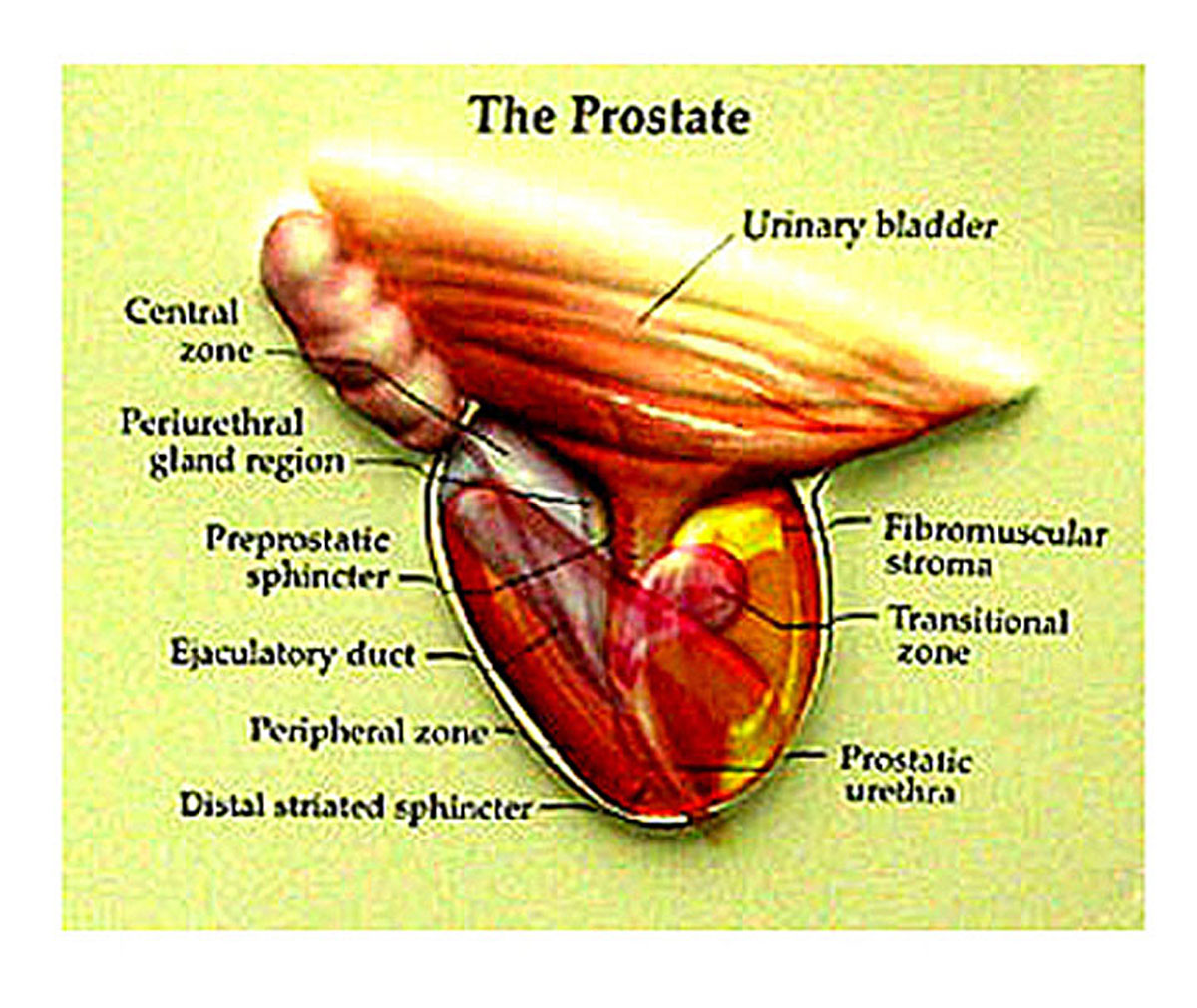 The routine PSA Test is another of the almost totally useless prostate procedures that can unnecessarily scare men.