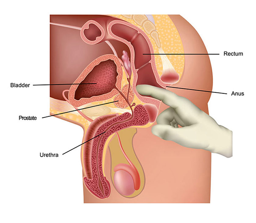 prostate milking