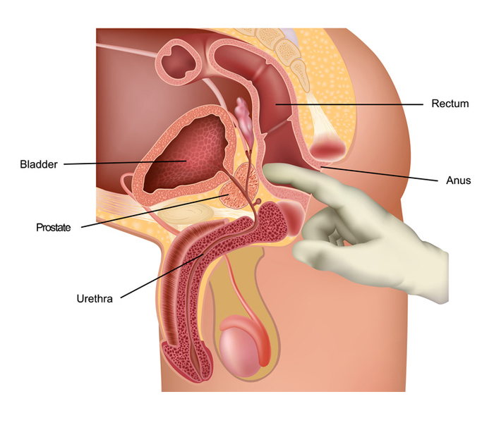 prostate treatment with massage