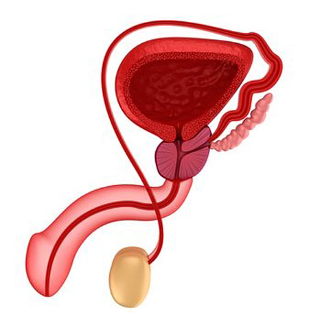 testicular pain and achy ball syndrome