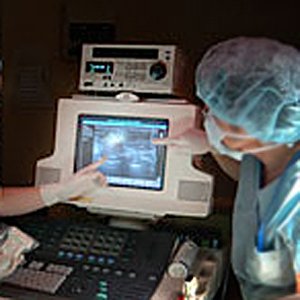 prostate ultrasound imaging