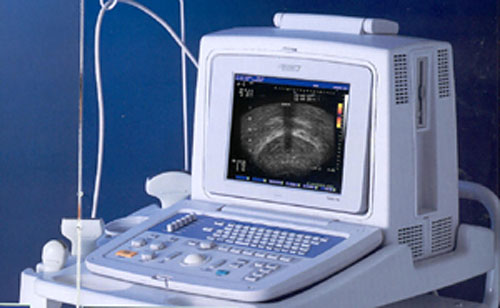 prostate ultrasound imaging vs needle biopsy